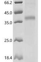 (Tris-Glycine gel) Discontinuous SDS-PAGE (reduced) with 5% enrichment gel and 15% separation gel.
