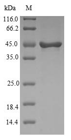 Recombinant Human Visinin-like protein 1 (VSNL1)