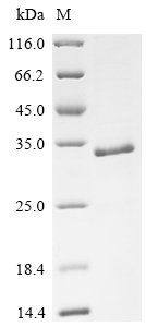 Recombinant Human Protein Wnt-5a (WNT5A), partial