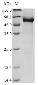 Recombinant Human Bifunctional 3'-5' exonuclease/ATP-dependent helicase WRN (WRN), partial, Homo sapiens (Human), E.coli, N-terminal 10xHis-tagged and C-terminal Myc-tagged, 58.3kDa, purity >85% as determined by SDS-PAGE.