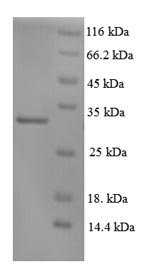Recombinant Human DNA repair protein complementing XP-C cells (XPC), partial