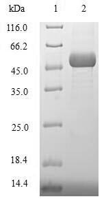 Recombinant Human DNA repair protein XRCC3 (XRCC3)