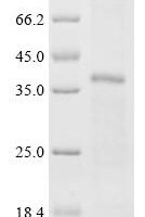 (Tris-Glycine gel) Discontinuous SDS-PAGE (reduced) with 5% enrichment gel and 15% separation gel.