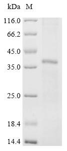 Recombinant Human Mas-related G-protein coupled receptor member D (MRGPRD) Protein, Homo sapiens (Human), in vitro E.coli expression system, N-terminal 10xHis-tagged, 42.2kDa, purity >85% as determined by SDS-PAGE.