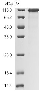 Recombinant Human Transcriptional coactivator YAP1 (YAP1)