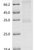 (Tris-Glycine gel) Discontinuous SDS-PAGE (reduced) with 5% enrichment gel and 15% separation gel.