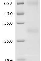 (Tris-Glycine gel) Discontinuous SDS-PAGE (reduced) with 5% enrichment gel and 15% separation gel.