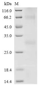 (Tris-Glycine gel) Discontinuous SDS-PAGE (reduced) with 5% enrichment gel and 15% separation gel.
