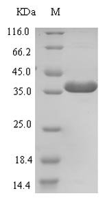Recombinant Human E3 ubiquitin-protein ligase ZNRF3 (ZNRF3), partial, Homo sapiens (Human), E.coli, N-terminal 6xHis-SUMO-tagged, 34.2kDa, purity >90% as determined by SDS-PAGE.