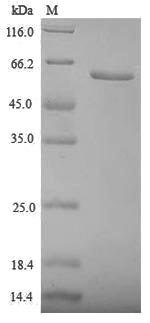 Recombinant Human Zona pellucida sperm-binding protein 3 (ZP3), partial