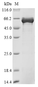 Recombinant Human Zinc finger protein ZPR1 (ZPR1)
