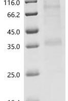 (Tris-Glycine gel) Discontinuous SDS-PAGE (reduced) with 5% enrichment gel and 15% separation gel.