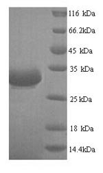 Recombinant Escherichia phage T7 Single-stranded DNA-binding protein (2.5), Escherichia phage T7 (Bacteriophage T7), Yeast, Tag-Free, 27.7kDa, purity >90% as determined by SDS-PAGE.