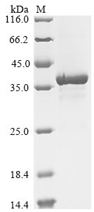Recombinant Escherichia phage RB69 Gp32 (32)