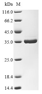 Recombinant Enterobacteria phage RB69 DNA polymerase (43), partial