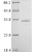 (Tris-Glycine gel) Discontinuous SDS-PAGE (reduced) with 5% enrichment gel and 15% separation gel.