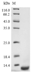 Recombinant Avian infectious bronchitis virus Non-structural protein 3b (3b)