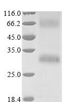 (Tris-Glycine gel) Discontinuous SDS-PAGE (reduced) with 5% enrichment gel and 15% separation gel.