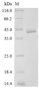 Recombinant Drosophila melanogaster 5-hydroxytryptamine receptor 2B (5-HT1B), partial, Drosophila melanogaster (Fruit fly), E.coli, C-terminal 6xHis-tagged, 34.0kDa, purity >95% as determined by SDS-PAGE.