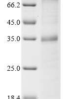 (Tris-Glycine gel) Discontinuous SDS-PAGE (reduced) with 5% enrichment gel and 15% separation gel.