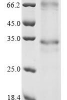 (Tris-Glycine gel) Discontinuous SDS-PAGE (reduced) with 5% enrichment gel and 15% separation gel.