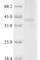 (Tris-Glycine gel) Discontinuous SDS-PAGE (reduced) with 5% enrichment gel and 15% separation gel.