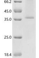 (Tris-Glycine gel) Discontinuous SDS-PAGE (reduced) with 5% enrichment gel and 15% separation gel.