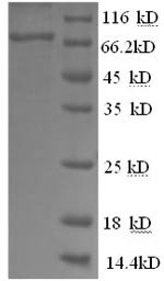 Recombinant Mouse Alpha-fetoprotein (Afp)