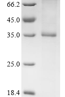 (Tris-Glycine gel) Discontinuous SDS-PAGE (reduced) with 5% enrichment gel and 15% separation gel.