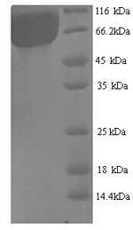 Recombinant Aspergillus niger Probable alpha-galactosidase B (aglB)