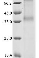 (Tris-Glycine gel) Discontinuous SDS-PAGE (reduced) with 5% enrichment gel and 15% separation gel.
