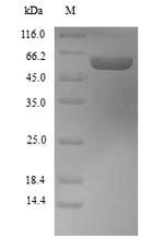 Recombinant Mouse Aldehyde dehydrogenase 1A1 (Aldh1a1)