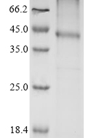 (Tris-Glycine gel) Discontinuous SDS-PAGE (reduced) with 5% enrichment gel and 15% separation gel.