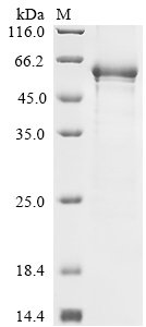 Recombinant Rat Aldehyde dehydrogenase, mitochondrial (Aldh2)