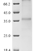 (Tris-Glycine gel) Discontinuous SDS-PAGE (reduced) with 5% enrichment gel and 15% separation gel.