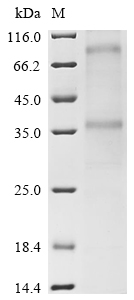 Recombinant Macaca mulatta C-C chemokine receptor type 8 (CCR8) Protein, Macaca mulatta (Rhesus macaque), in vitro E.coli expression system, N-terminal 10xHis-tagged, 42.7kDa, purity >85% as determined by SDS-PAGE.