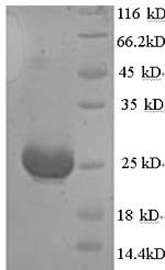 Recombinant Mouse Anti-Muellerian hormone (Amh), partial, Mus musculus (Mouse), Yeast, N-terminal 6xHis-tagged, 13.3kDa, purity >90% as determined by SDS-PAGE.