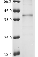 (Tris-Glycine gel) Discontinuous SDS-PAGE (reduced) with 5% enrichment gel and 15% separation gel.
