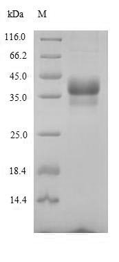 Recombinant Mouse Anthrax toxin receptor 1 (Antxr1), partial