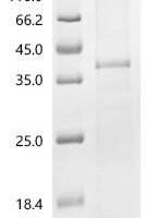 (Tris-Glycine gel) Discontinuous SDS-PAGE (reduced) with 5% enrichment gel and 15% separation gel.