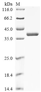 Recombinant Mouse Annexin A2 (Anxa2)