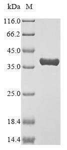 Recombinant Mouse Annexin A4 (Anxa4), partial