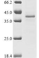 (Tris-Glycine gel) Discontinuous SDS-PAGE (reduced) with 5% enrichment gel and 15% separation gel.
