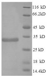 Recombinant Mouse Apolipoprotein E (Apoe), Mus musculus (Mouse), Yeast, N-terminal 6xHis-tagged, 36.0kDa, purity >90% as determined by SDS-PAGE.
