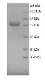 Recombinant Mouse Arginase-1 (Arg1), Mus musculus (Mouse), Yeast, N-terminal 6xHis-tagged, 36.8kDa, purity >90% as determined by SDS-PAGE.