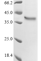 (Tris-Glycine gel) Discontinuous SDS-PAGE (reduced) with 5% enrichment gel and 15% separation gel.