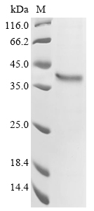 Recombinant Human G-protein coupled receptor 62 (GPR62) Protein, Homo sapiens (Human), in vitro E.coli expression system, N-terminal 10xHis-tagged, 39.1kDa, purity >85% as determined by SDS-PAGE.