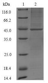 Recombinant Mouse Acid ceramidase (Asah1), partial, Mus musculus (Mouse), E.coli, N-terminal 10XHis-GST-tagged and C-terminal Myc-tagged, 43.8kDa, purity >90% as determined by SDS-PAGE.