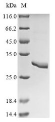 Recombinant Rat Asialoglycoprotein receptor 1 (Asgr1), partial, Rattus norvegicus (Rat), E.coli, N-terminal 6xHis-tagged, 30.1kDa, purity >90% as determined by SDS-PAGE.