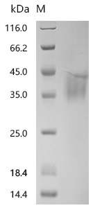 Recombinant Mouse Asialoglycoprotein receptor 1 (Asgr1), partial, Mus musculus (Mouse), Mammalian cell, C-terminal 10xHis-tagged, 27.3kDa, purity >95% as determined by SDS-PAGE.